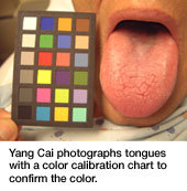 Tongue color changes from illnesses