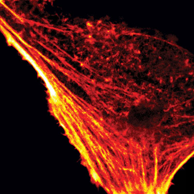 fluorescence confocal microsope image of actin cytoskeleton