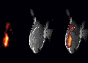 Images of a mouse quadriceps