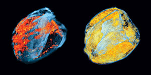 3D renderings of MRI images showing the distribution of macrophages infiltrating the heart at different stages of rejection