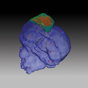 3D rendering of mouse brain after trauma