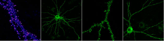 images of neurons