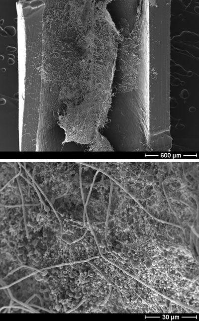 Scanning electron microscope images of C. albicans of biofilm