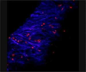 image of biofilm in a chinchilla ear