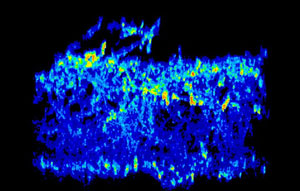 image of C. albicans biofilm