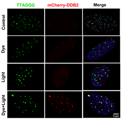 UV-DDB Finds Damaged DNA in Living Cells