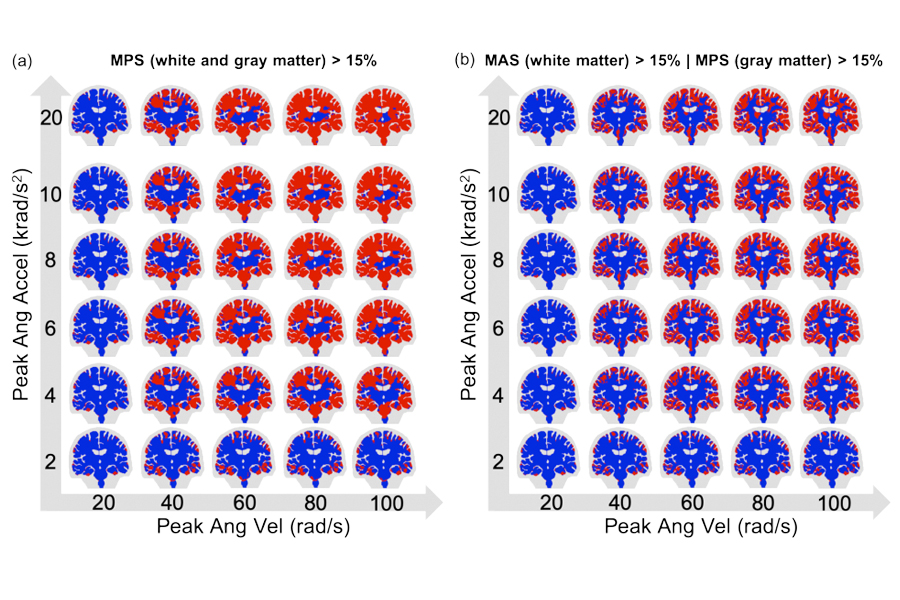 Virtual Brain Injury Study Identifies Key Factors in Potential Nerve-Fiber Damage