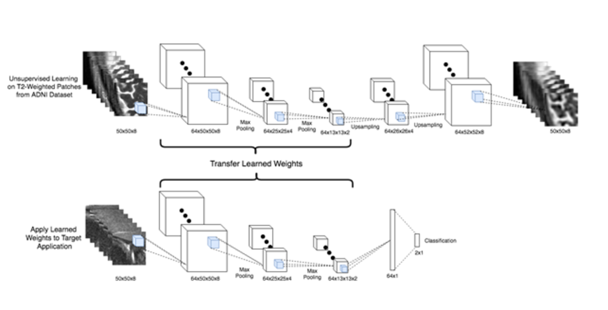 Applying Machine Learning Methods toward Classification based on Small Datasets with Application to Shoulder Labral Tears