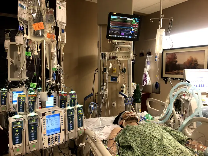 Tristan Mace in ICU on ventilator while waiting to be listed for his heart transplant (February 20, 2021). Photo courtesy of Jordan Mace