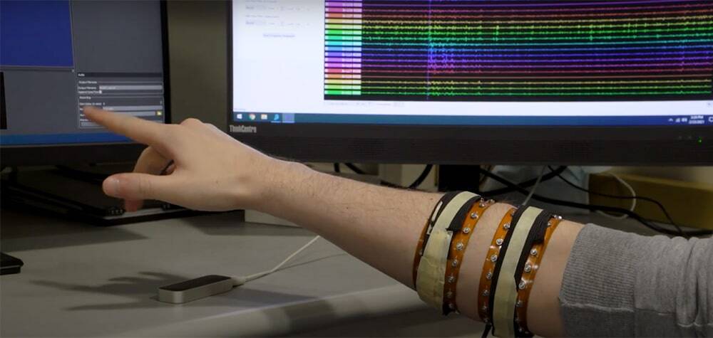 A sensor on an arm