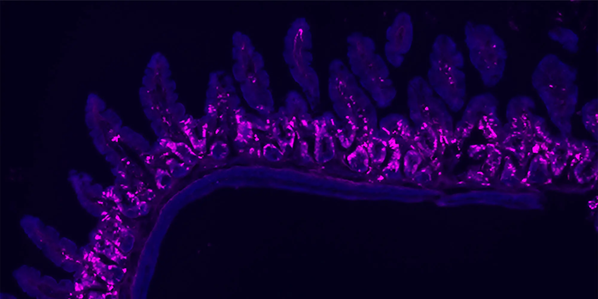 Tuft cells