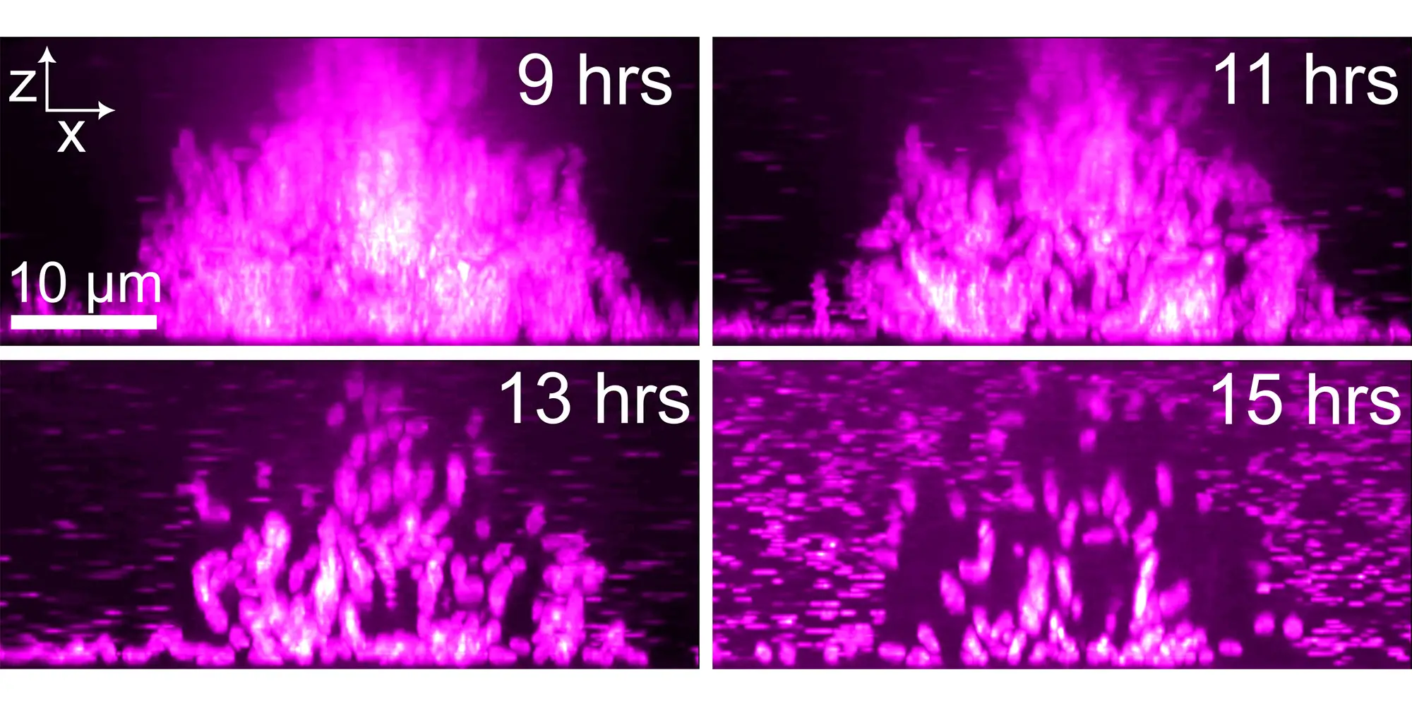 Microscope images showing bacteria leaving a biofilm