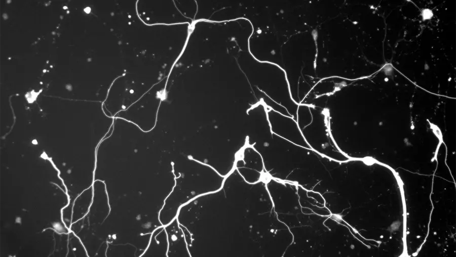 black and white abstract of  neurons