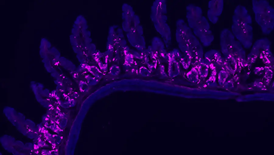 Tuft cells