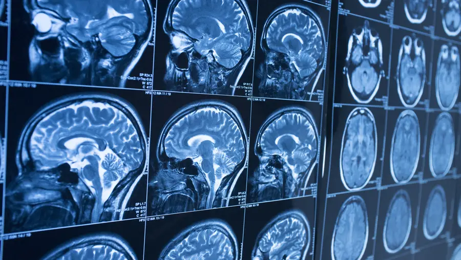 A wall full of brain scans.