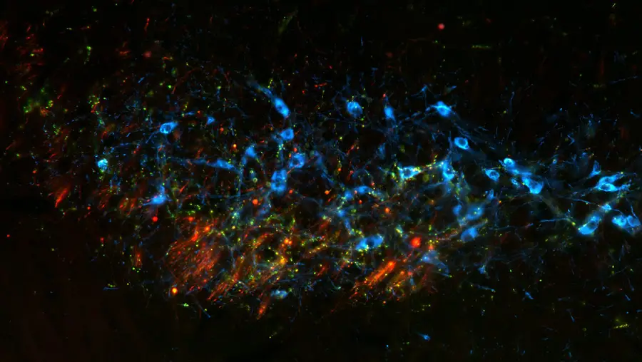 Colorful image shows different types of nerves.