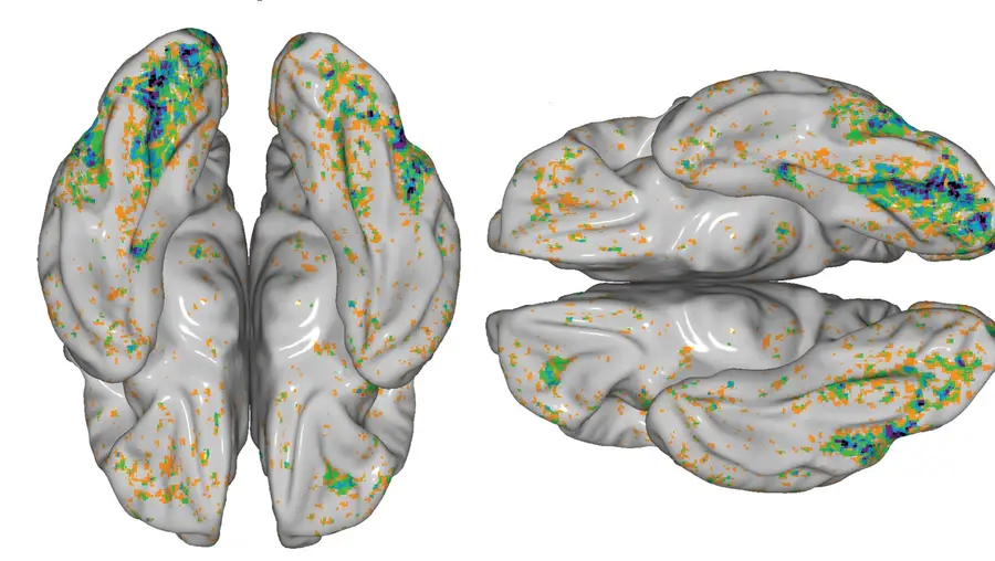 Graphic depicting a region of the brain's visual cortex that responds to food. The brain is colored in shades of grey, while the highlighted areas of the brain are depicted with orange, green, blue, and purple pixels.