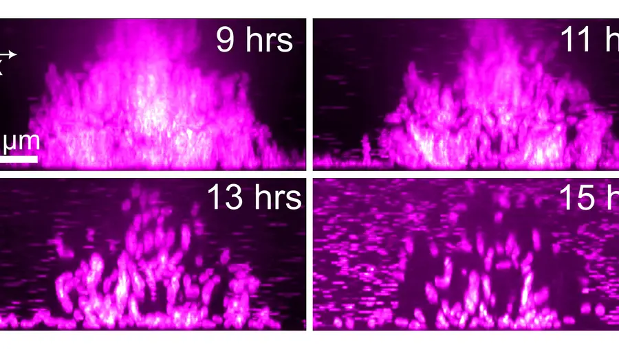 Microscope images showing bacteria leaving a biofilm