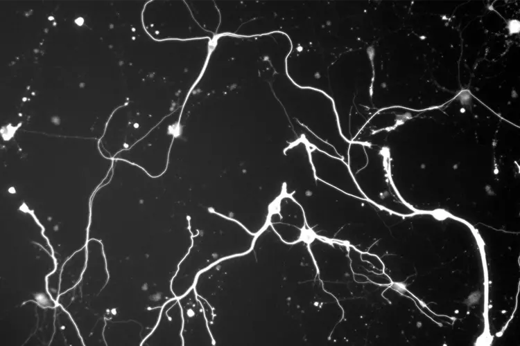 black and white abstract of  neurons