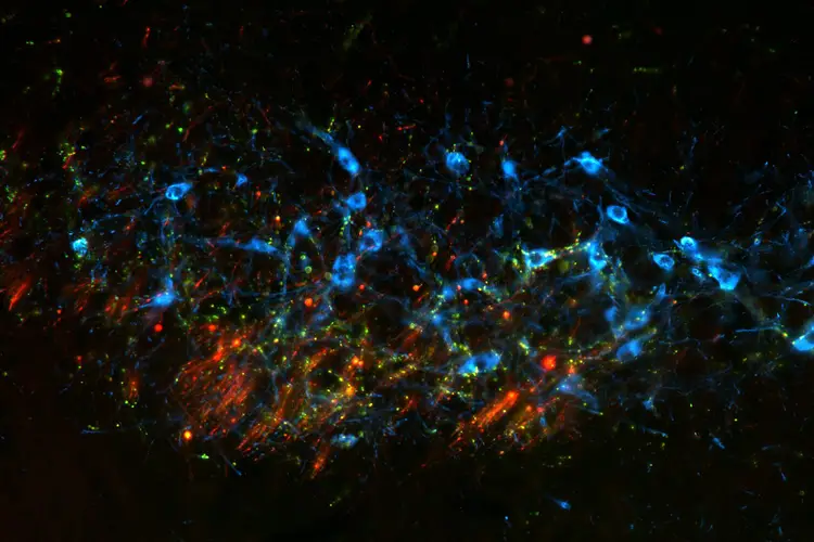 Colorful image shows different types of nerves.