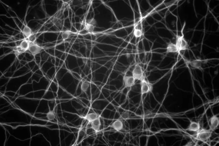 neuron-modeling-slideshow-03-min.jpg