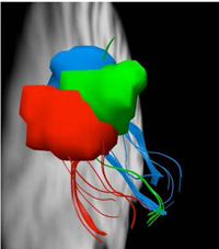 Image of the parietal cortex: The three colors demonstrate one-to-one mapping from the first place visual information comes from the eyes and its path to the parietal cortex.  (Courtesy of Carnegie Mellon University.)