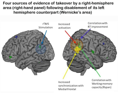 Brain Adapts To Injury