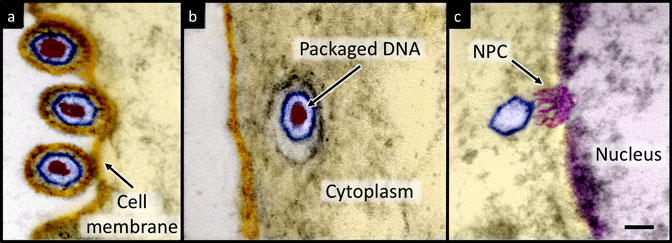 Herpes Virus