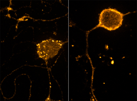 endosomes