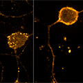 endosomes