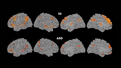 Brain Images