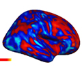 Brain Patterns in Autism