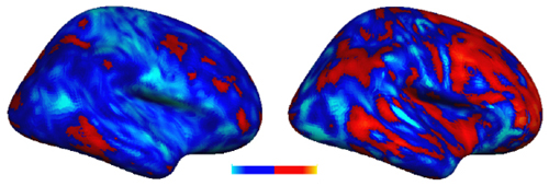 Brain Patterns in Autism