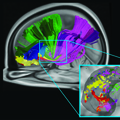 Brain Communicates