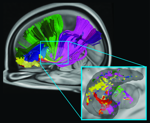 Brain Communicates