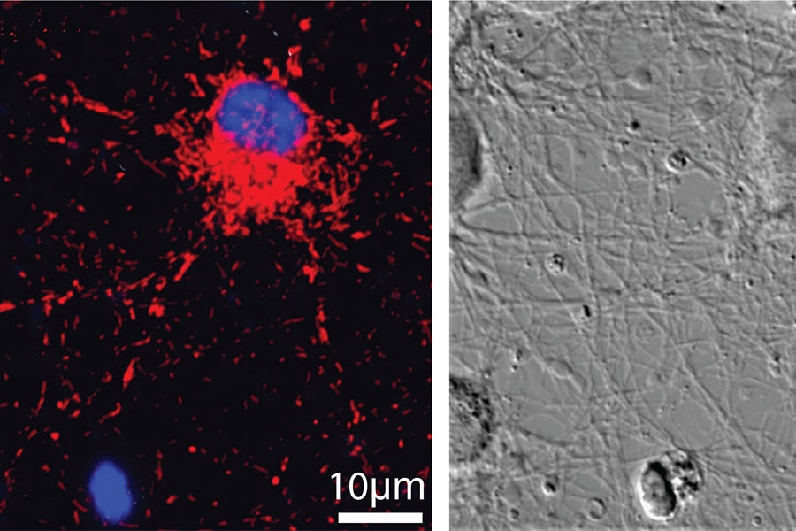 Optical microscope image of neuronal cells on graphene.