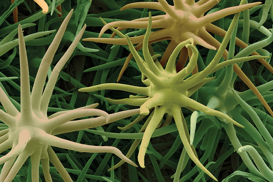 Image of Viburnum Stellate leaf hairs