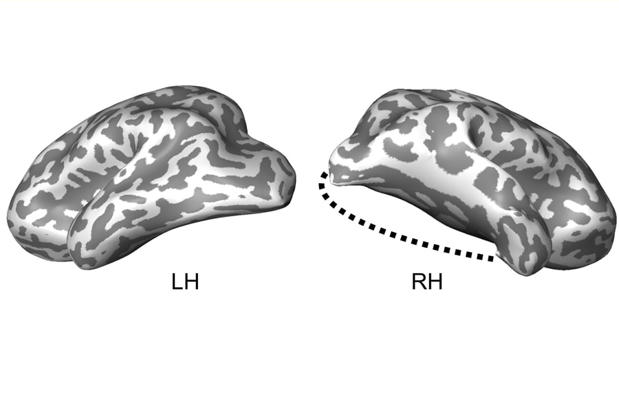 Graphic of brain
