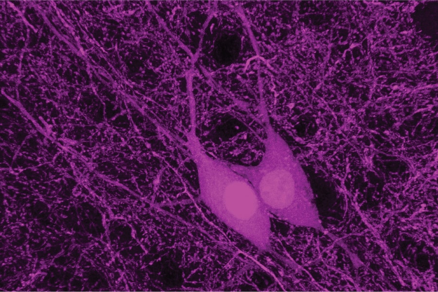 Image of a neuron