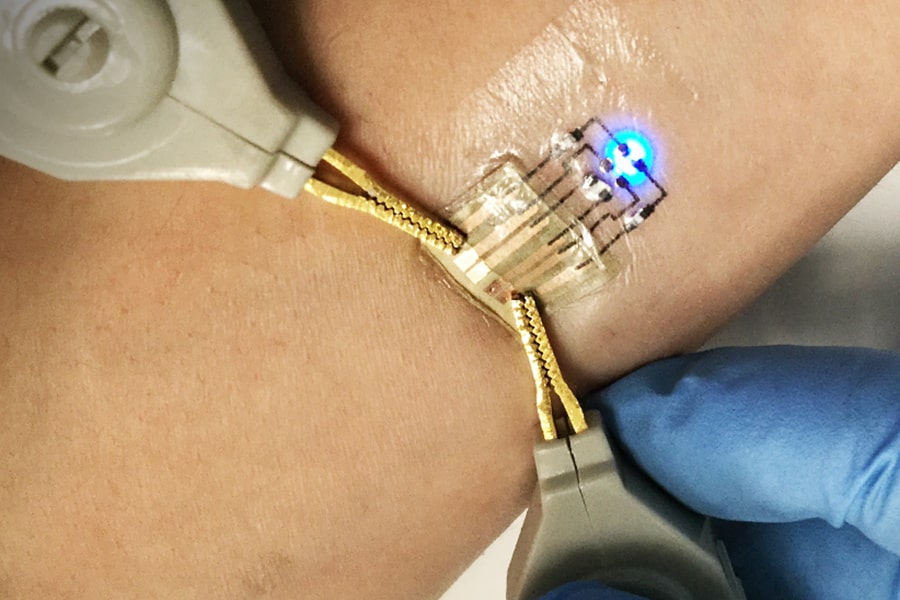 Image of electronic tattoo