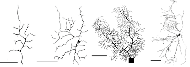 Image of Brain traffic