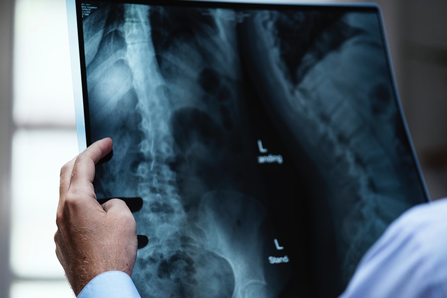 Image of doctor reviewing an x-ray