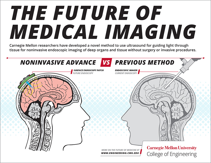 ultrasound-breakthrough-900.jpg