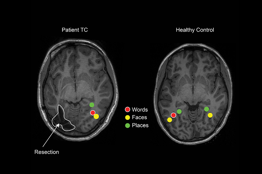 A scan of two brains.