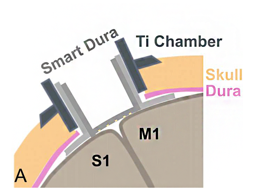 sketch of dura port