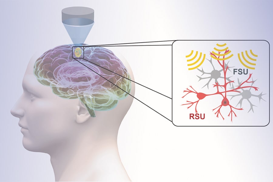 A diagram of a brain