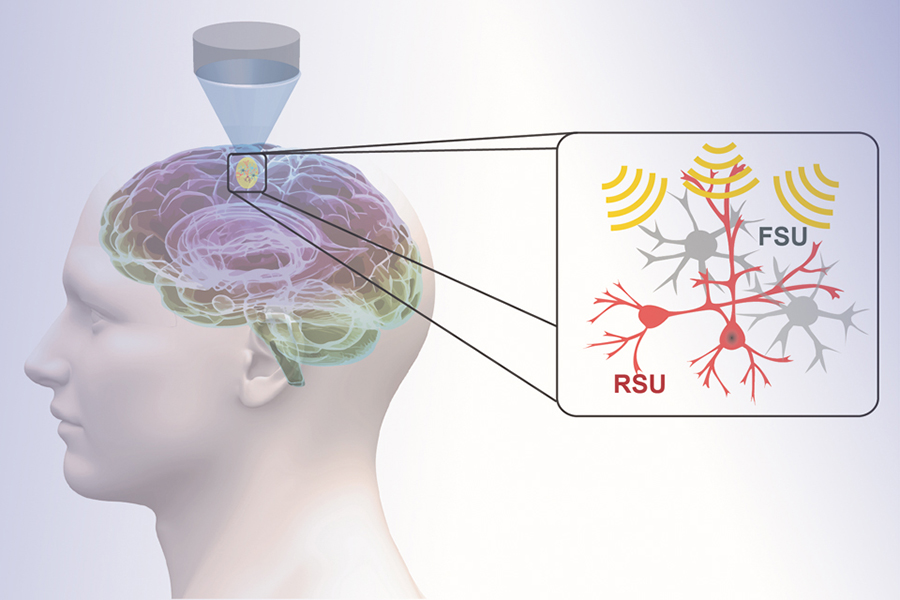 Graphic representation of the therapeutic method