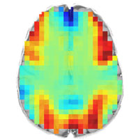 What Your Brain Looks Like When It Solves a Math Problem