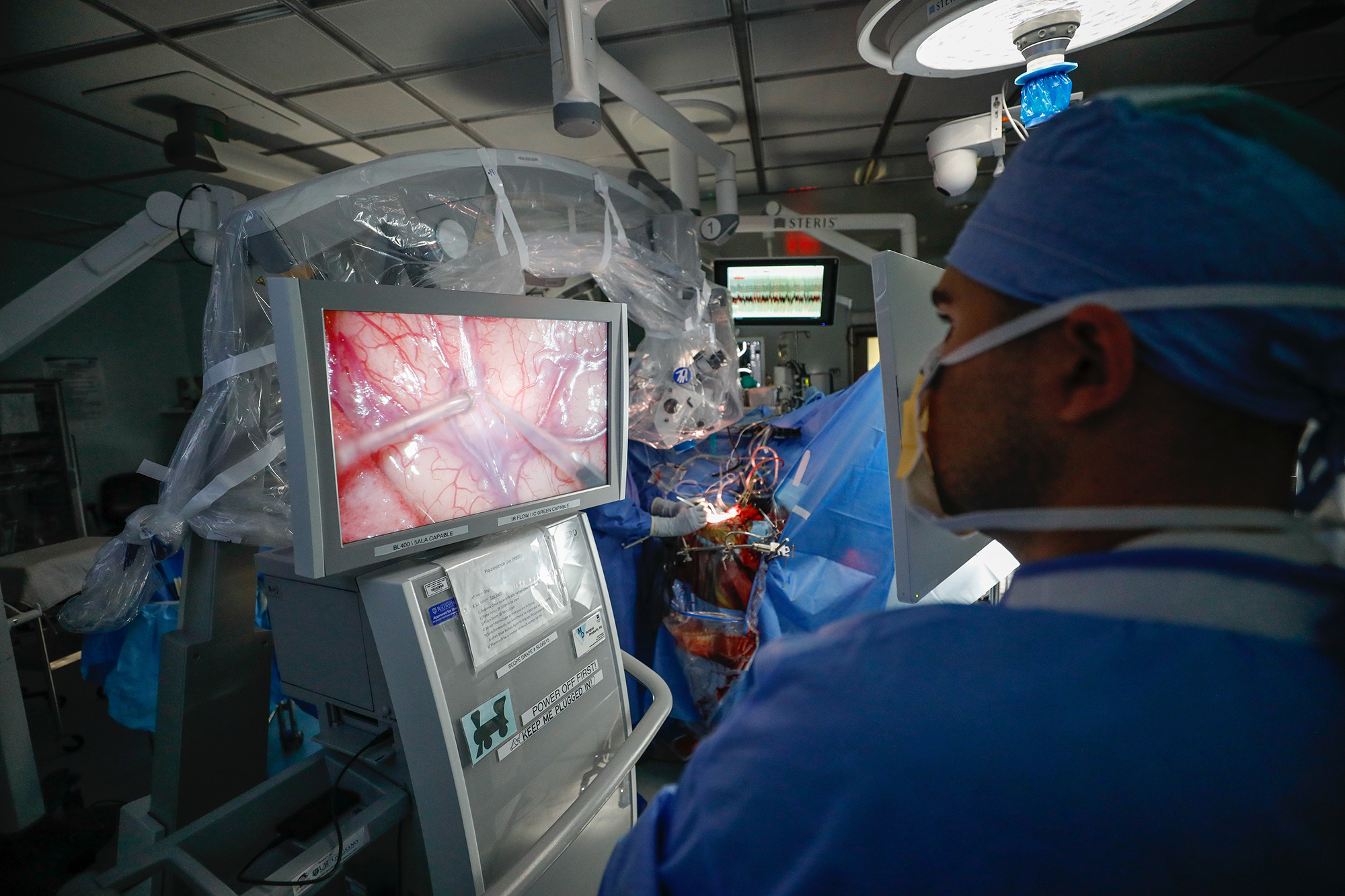 A doctor in surgical scrubs observes brain surgery on a screen from within the operating theater.