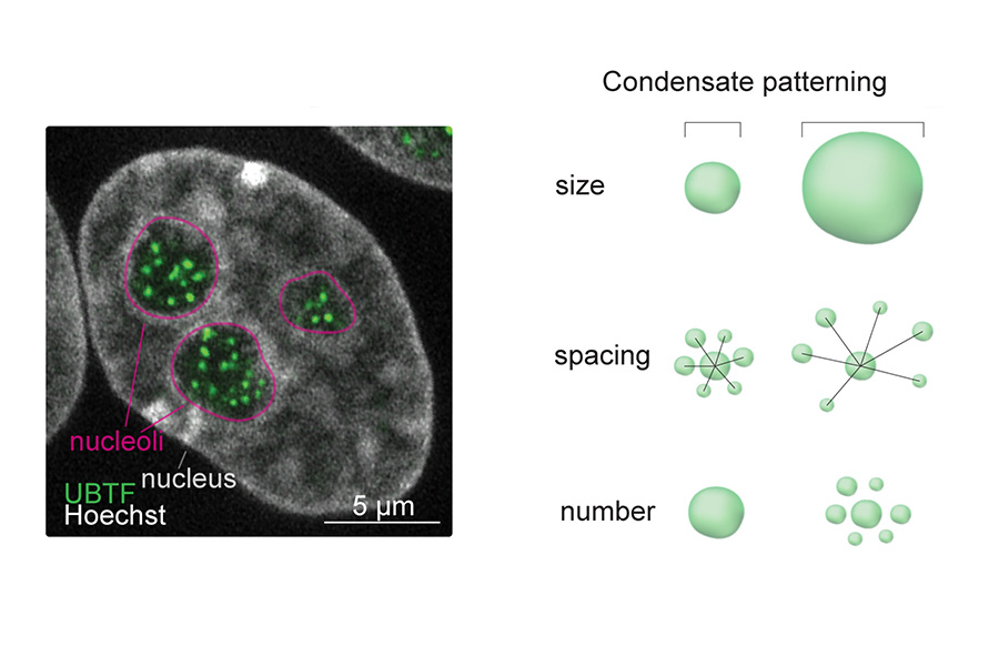 The left of the image shows a cell under the microscope, gray with green dots clustered inside. The right shows a diagram of condensates as small balls of varying spacing and number.